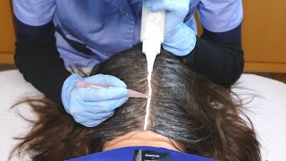 ASMR Scalp Check with BAD Results and TREATMENT (Real Person)