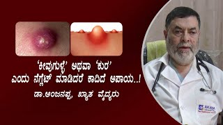 'ಕುರ'ಎಂದು ನೆಗ್ಲೆಟ್ ಮಾಡಿದರೆ ಕಾದಿದೆ ಆಪತ್ತು..!Furuncles and Carbuncles//Dr.Anjanappa