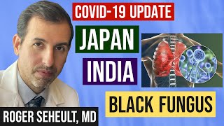 Coronavirus Update 128: India, Japan, The Olympics, Mucormycosis