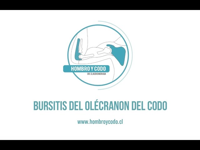 Codo: Bursitis olecraneana