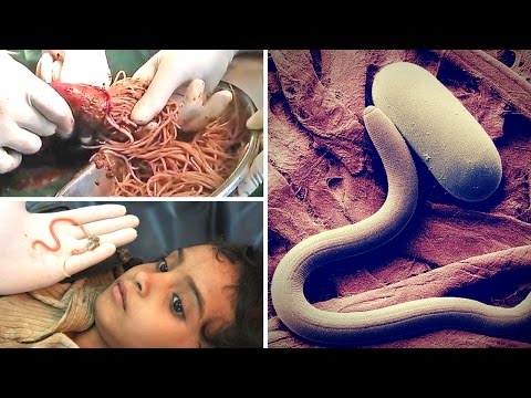 Natural Way To Get Rid Of Web Worms Natural Way To Get Rid Of Web Worms