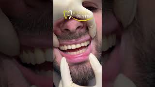 Вишукана робота лікаря Бараник Анастасії😍  #dentist #dentalclinic #dnipro #ukraine