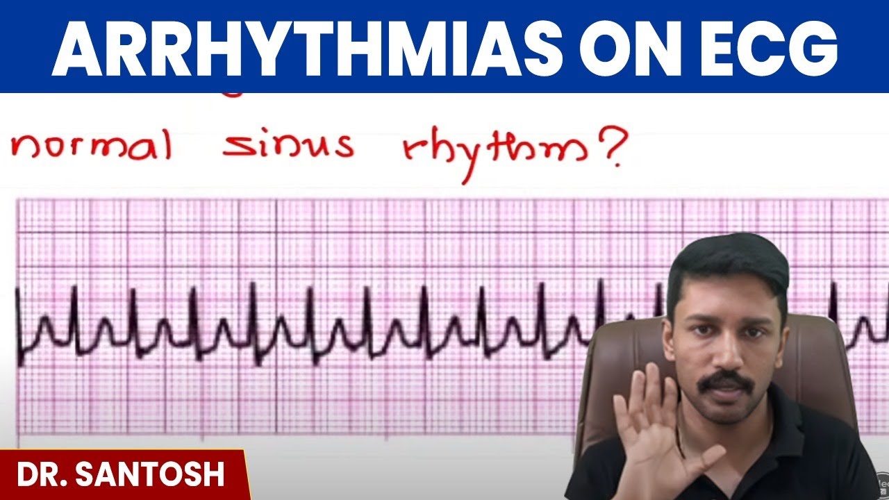 Arrhythmias on ECG | Medicine | Master ECG Series with Dr. Santosh | PW MedEd