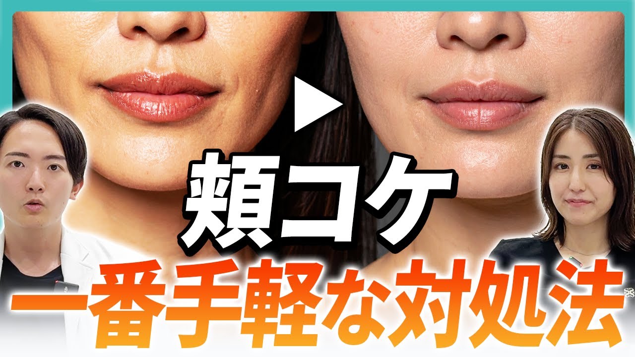 【急増中】頬コケで老け顔になる前に！美容ドクターが教える最強対策法