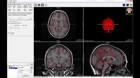 Analyze 14.0 - Segment: Single Object Segmentation