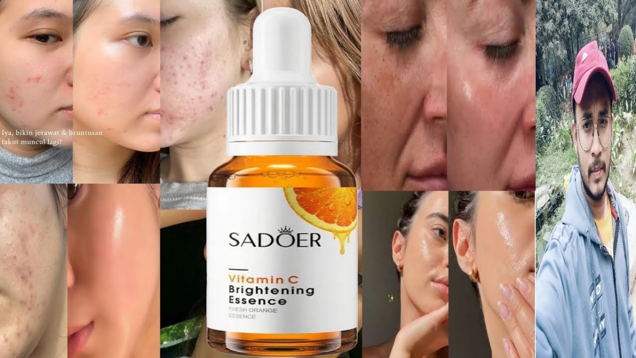 Sadoer Vitamin C Brightening Essence | Honest Review