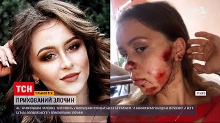 Новини України: сина керівника поліції звинувачують у наїзді на дівчину на службовому авто батька