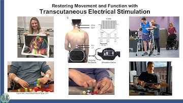 Restoring Movement and Function with Transcutaneous Electrical Stimulation