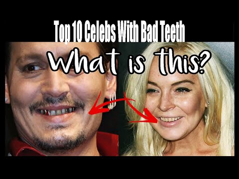 Top 10 Celebs With Bad Teeth
