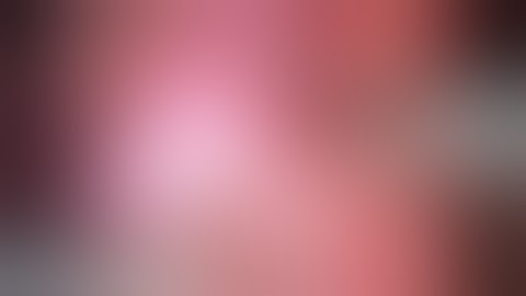 Robotic Partial Nephrectomy - Step 4: Hilar Dissection