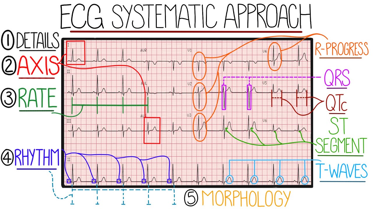ECG Interpretation Made Easy Learn How to Interpret an ECG in 13 Minutes