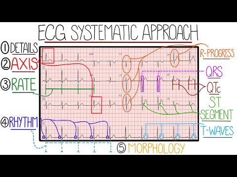 Video: Mis on S-laine EKG-s?