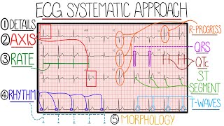 ECG Interpretation Made Easy (Learn How to Interpret an ECG in 13 Minutes) screenshot 1