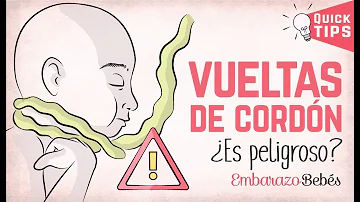 ¿Puede un bebé enredarse con el cordón umbilical en el útero?