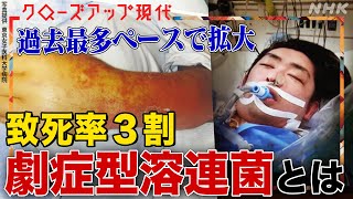 【致死率3割】「劇症型溶連菌」が過去最多ペースで拡大 感染経路は？毒性が強い"M1UK株"とは？容体急変し手足の切断に至ることも(語り:小松未可子)【クロ現】| NHK