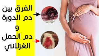 الفرق بين دم الدورة الشهرية و دم الحمل الغزلاني  هكذا يمكنكِ أن تُميِّزي بينهما