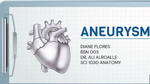 Aneurysm | Diane Flores