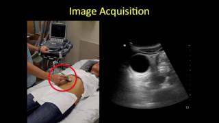 Gallbladder point of care ultrasound tutorial