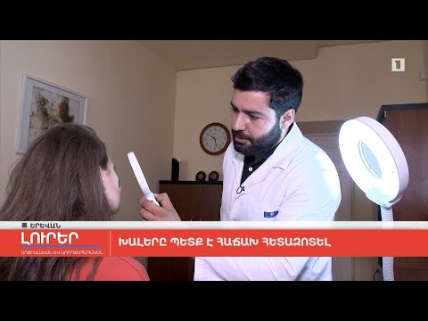 Video: Խալը պետք է ցավի՞: