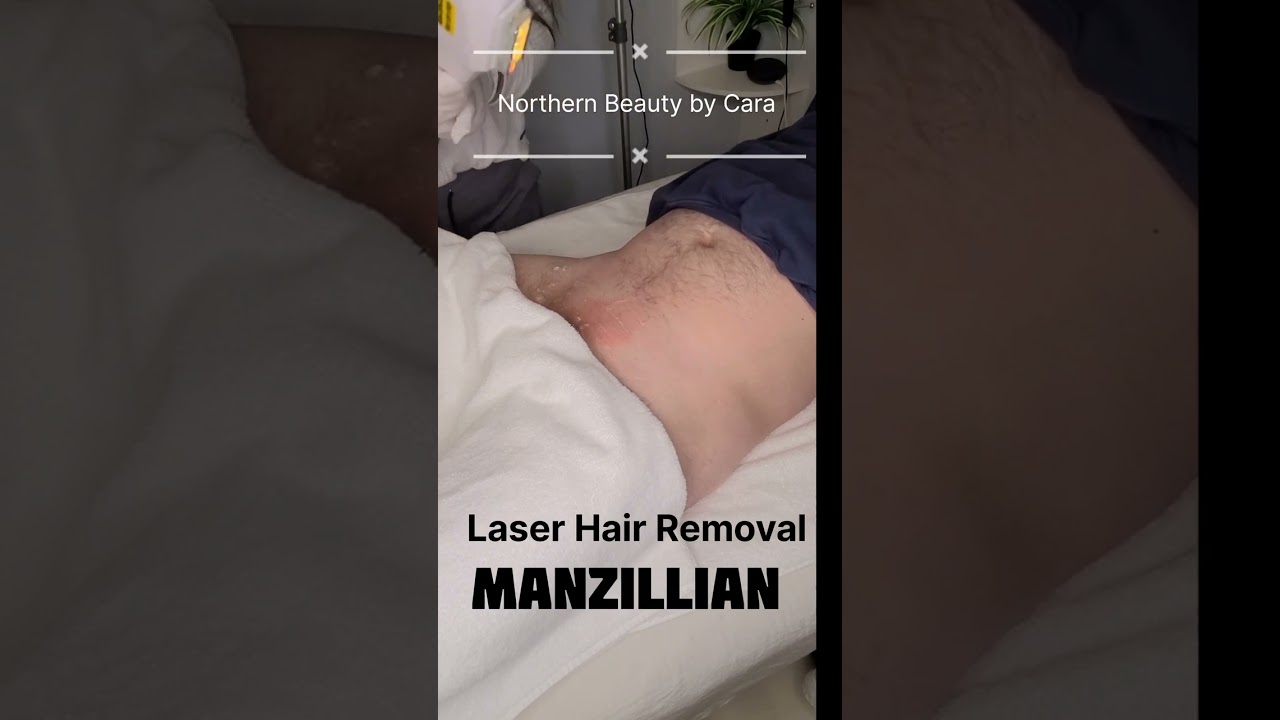 Ever Wonder about Manzillian Laser Hair Removal? Here is a Quick Peek.