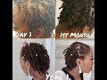 My 1 Year Loc Journey From Day 1| Low Density Locs | Thin Fine Locs | Alopecia | Loc Tips And Advice