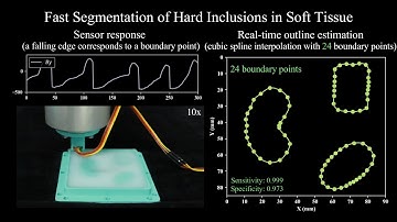 Fast localization and segmentation of tissue abnormalities by autonomous robotic palpation