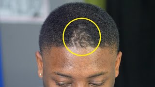 HIS HAIRLINE GROWS BACKWARDS 😳 *IMPOSSIBLE FIX*