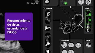 Voluson Performance Series: SonoLyst |  GE HealthCare