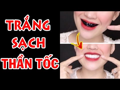 sản phẩm chăm sóc răng miệng tại Kemtrinam.vn