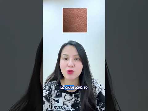 Da dầu lô chân lông to dùng NIA được không ? #nguyenmaihuong #chamsocda #skincare #reels