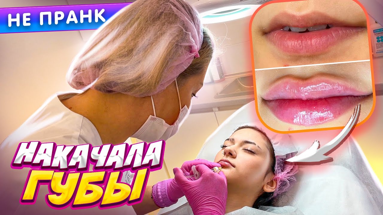 Фото жене лиза губа