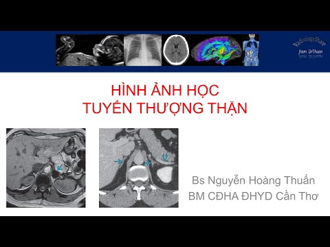Video Hình ảnh học tuyến thượng thận Part1 - youtube