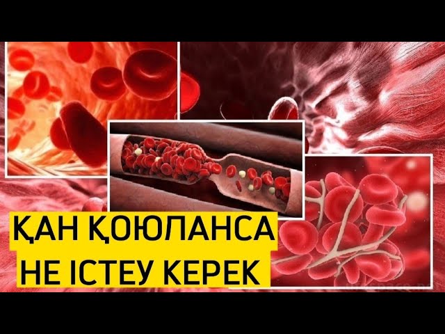 Оның кискасы суланып қалды