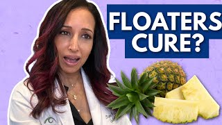 Natural Cure For Eye Floaters? Eye Doctor Explains
