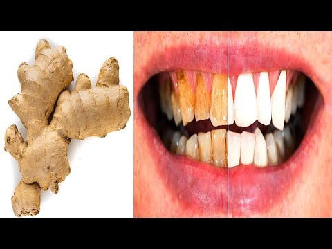 Video: Wie Wurden Zähne In Russland Mit Maulwürfen Behandelt Und Wie Mit Birkenmulden Verzehrt? - Alternative Ansicht
