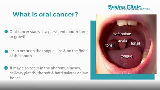 15 Minute OncAlert™ Oral Cancer Testing Frequently Asked Questions   Savina Dental Clinics Malta and screenshot 4