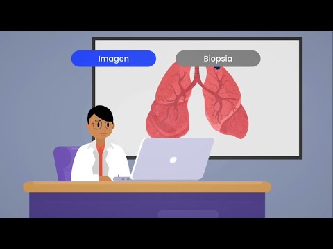 ¿Qué es la estadificación del cáncer de pulmón?