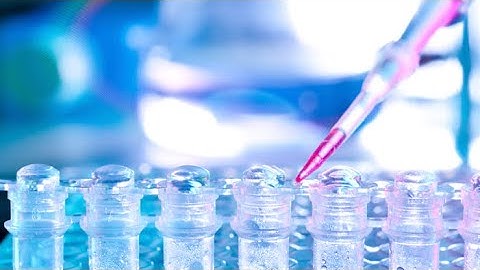 RNA-Sequencing Between Sample Normalization Strategies