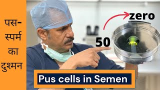pus cells in semen|पस-स्पर्म का दुश्मन| Dr. Sunil Jindal|Jindal Hospital Meerut
