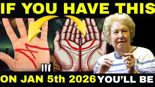 Download Lagu If You Have the ‘M’ or Crescent Mark on Your Palm, You Are An Earth Angel (Here Are 7 Signs) MP3