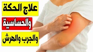 علاج الهرش فى الجسم ( علاج الحكة الجلدية ) علاج الحساسيه والحكه