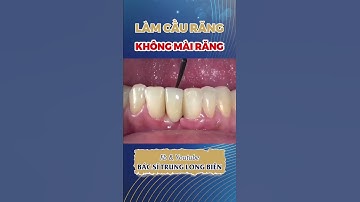 Làm Cầu Răng Không Mài Răng | Nha Khoa Long Biên #shorts