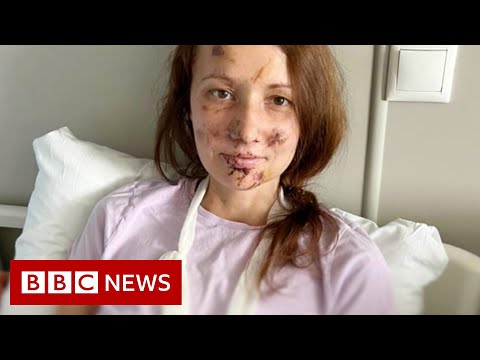 Russian woman rescued from bomb site in Ukraine - BBC News