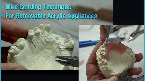 Wire Bending Technique for Removable Acrylic Appliances