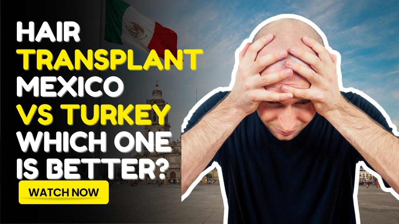 Hair Transplant In Mexico vs Turkey Which is Better? YouTube Hair Transplant In Mexico vs Turkey Which is Better? YouTube