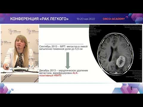 Клинический случай №2.Эффективность