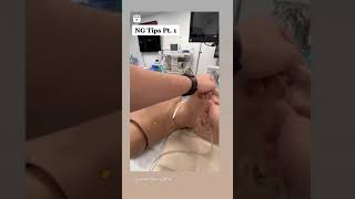 Nazogastri̇k Sonda Takılması Thanks @Anesthesia2Life