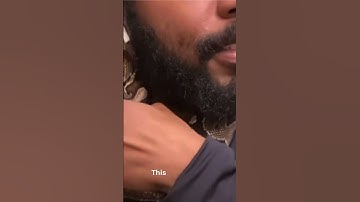 Don’t blink guy’s snake bites him 😳