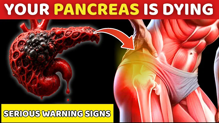 8 Symptoms of PANCREATIC CANCER That Will SHOCK YOU | Serious warning signs | Senior Health