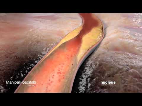 თამბაქო